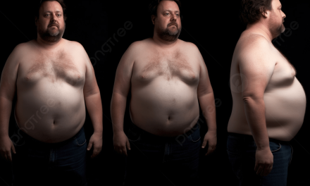 Tubuh Gemuk, Ini Dia Cara Menyikapinya Secara Sehat